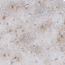 TOM1 Antibody, Novus Biologicals:Antibodies:Primary Antibodies